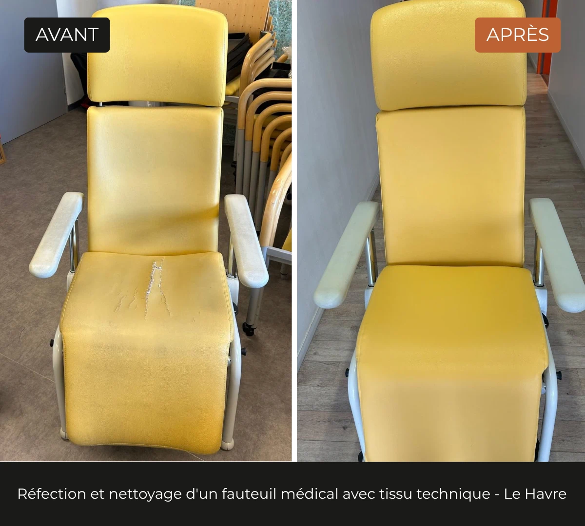 Avant, après d'un fauteuil médical avant réfection, simili jaune fissuré. Retapissé avec un tissu technique sanitaire jaune.